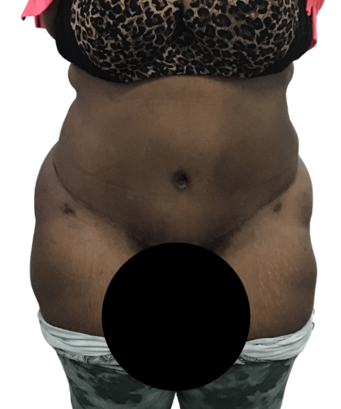 Belly 2
