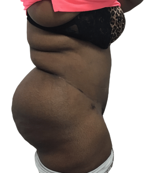 Belly 8